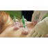 Cupping Set Elektrisch